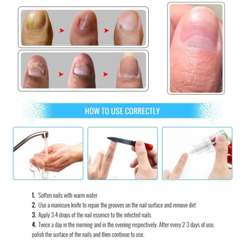 Крем для нігтів, що відновлює OmyLady Fungal Nails Treatment 10мл - 3