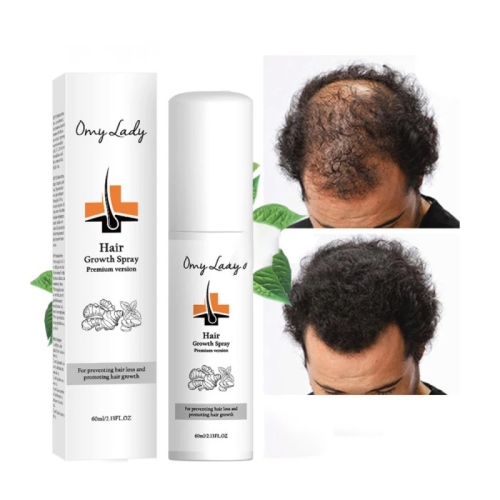 Спрей для роста волос против выпадения волос OmyLady Hair Growth Spray 60мл - 1